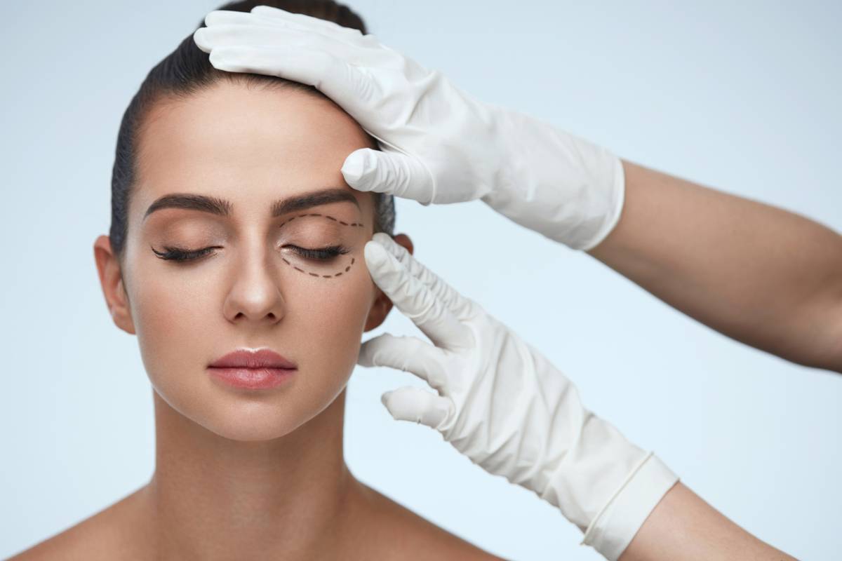 eyelid surgery patient with dotted lines around eye, gloved hands holding her head