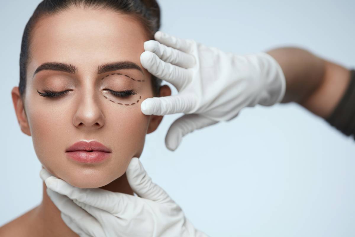 Woman about to get eyelid surgery