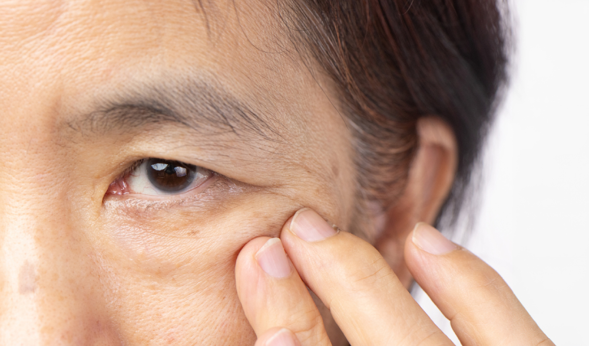 Featured image for What Is the Main Cause of Ptosis